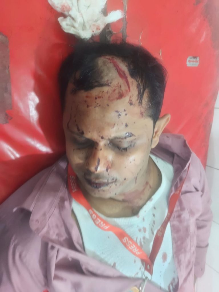 কালীগঞ্জে সাংবাদিক জাকারিয়া আল মামুনের ওপর সন্ত্রাসী হামলার তীব্র নিন্দা ও দ্রুত বিচার দাবী