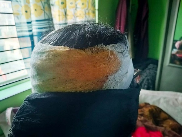 ঢাকা-৪ সংসদীয় আসনে গণসংযোগকালে জামায়াত নেত্রীকে কুপিয়ে জখম, জামায়াতের তীব্র নিন্দা ও প্রতিবাদ